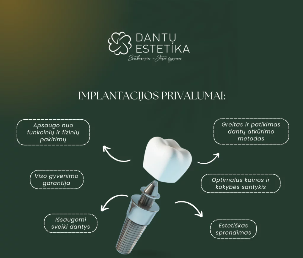 Dantų implantai - privalumai